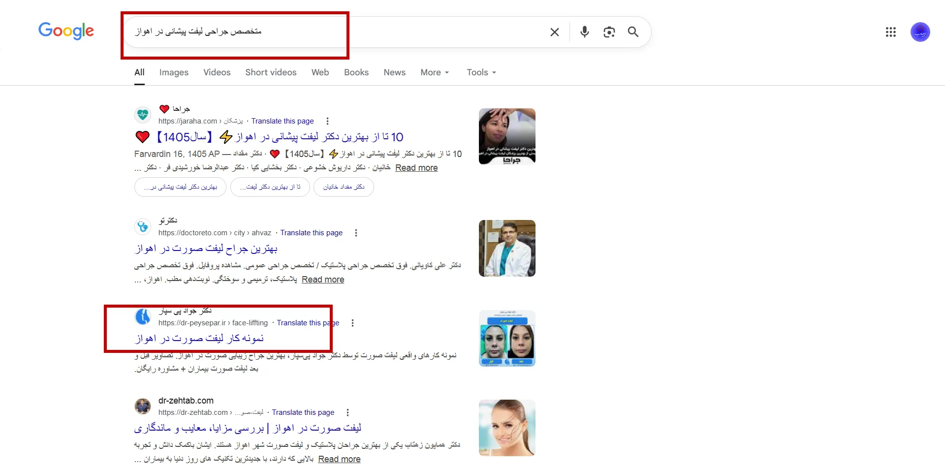 نتیجه سرچ متخصص لیفت پیشانی در اهواز برای سایت دکتر جواد پی سپار