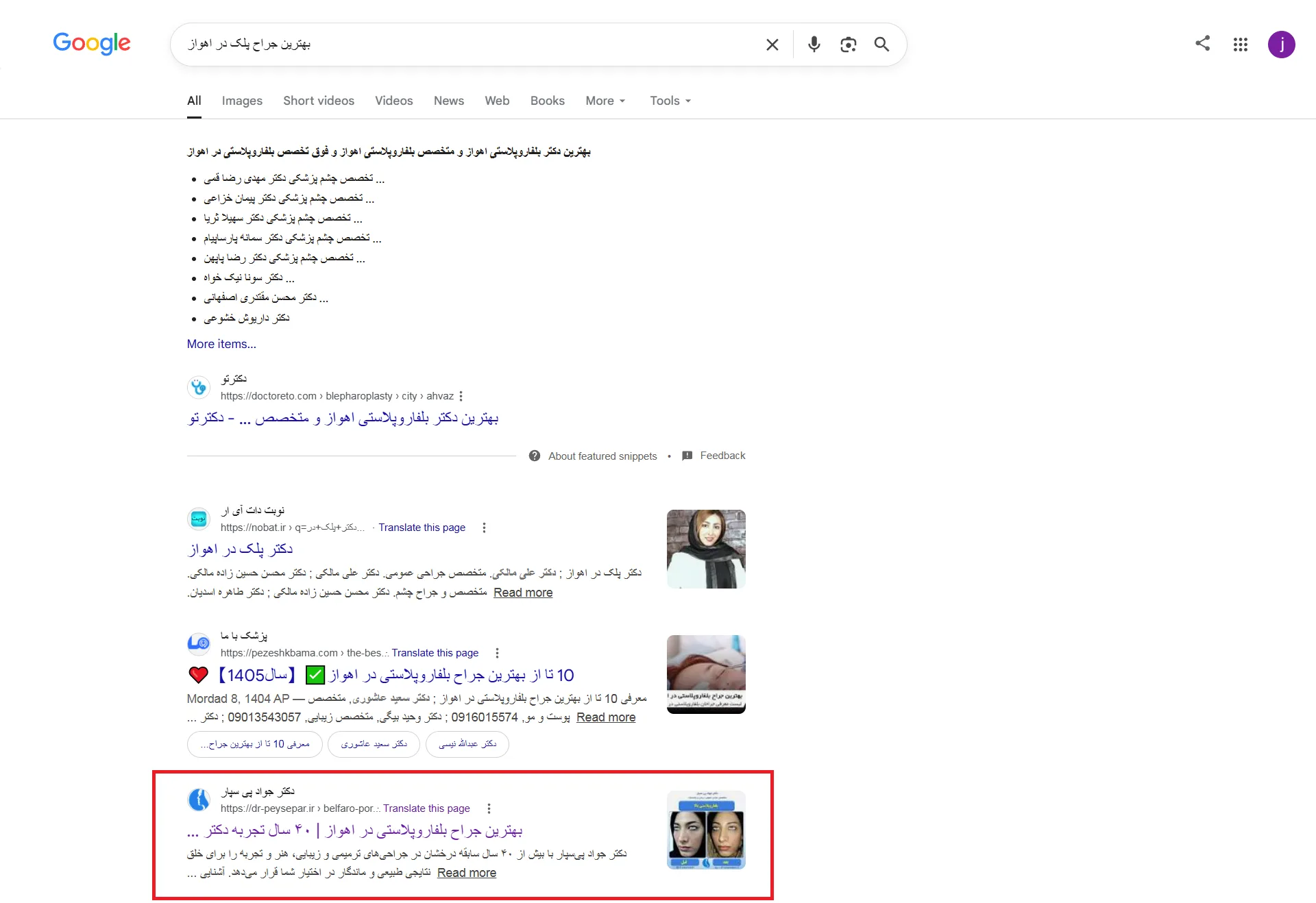 نتیجه سئو سایت دکتر جواد پی سپار بهترین جراح پلک در اهواز