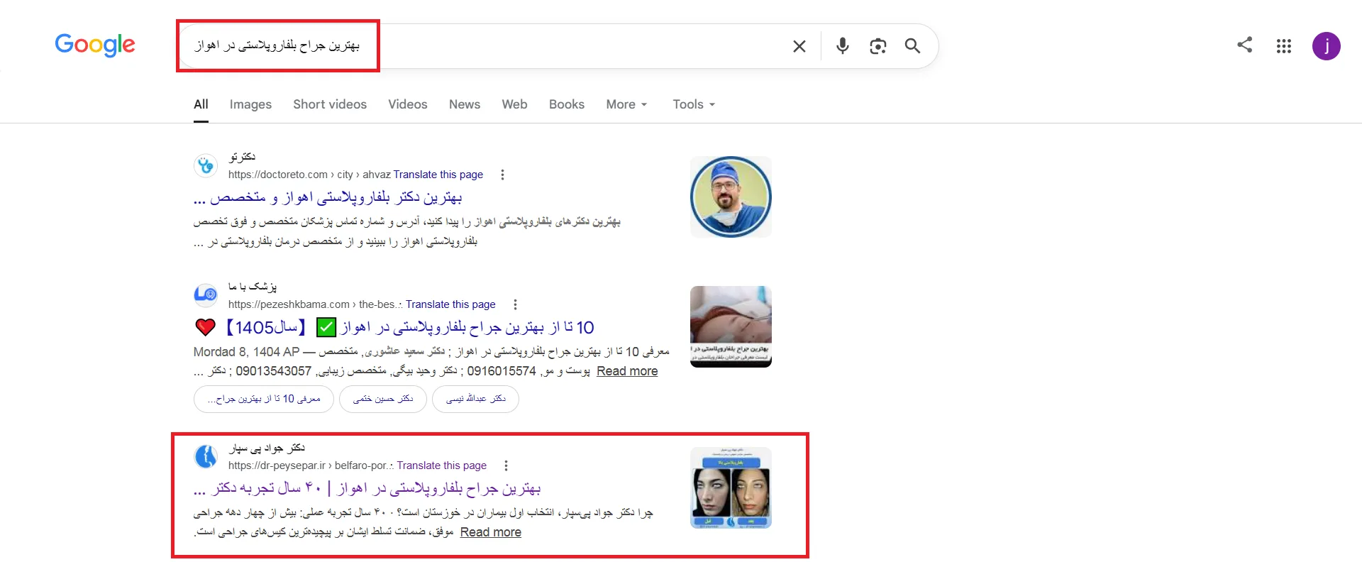 نتیجه سئو سایت دکتر جواد پی سپار بهترین جراح بلفاروپلاستی در اهواز