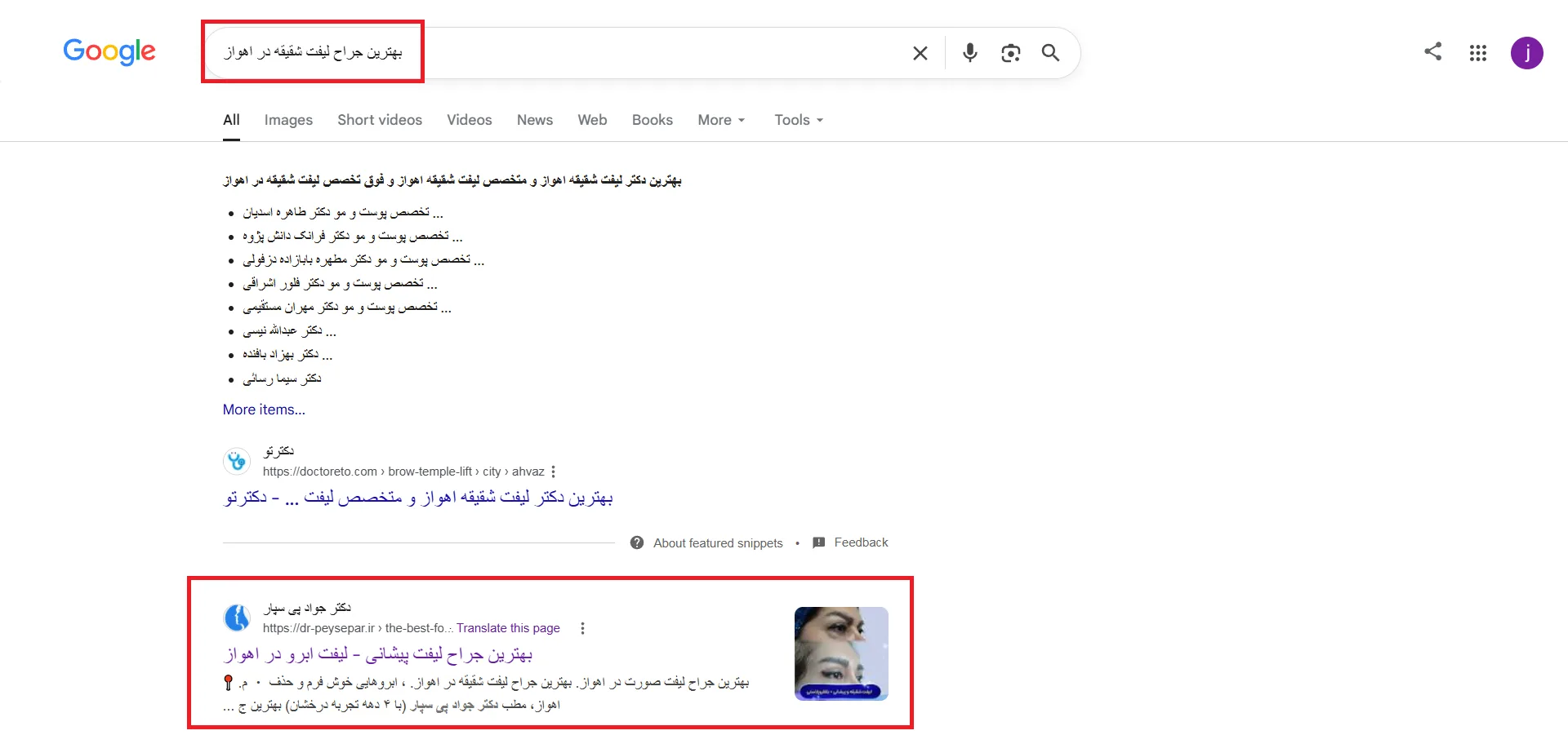 نتیجه سئو سایت دکتر جواد پی سپار بهترین جراح لیفت شقیقه در اهواز